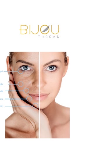 Bijou Thread — usporedba lica prije i poslije uz označene zone tretmana